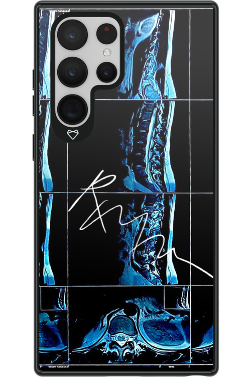 RMN Scolioza 2.0 - Samsung Galaxy S22 Ultra