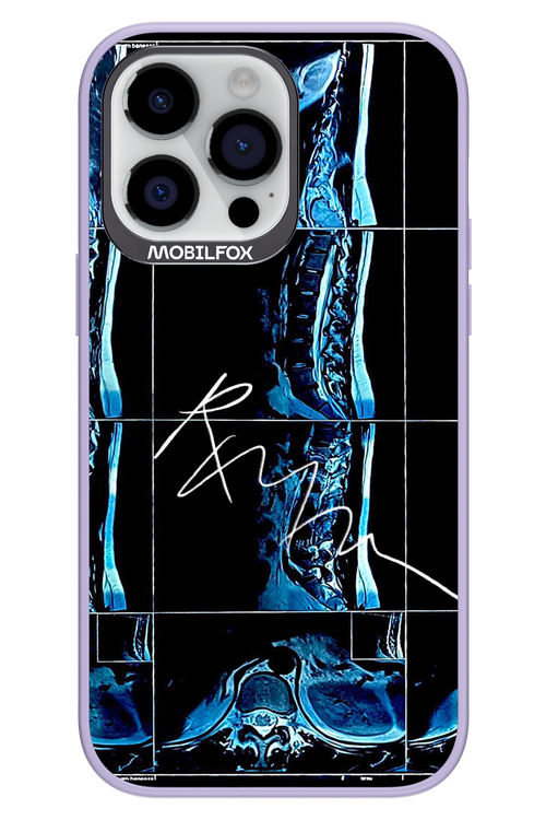 RMN Scolioza 2.0 - Apple iPhone 14 Pro Max