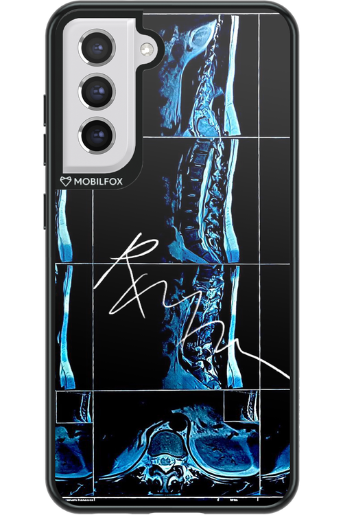 RMN Scolioza - Samsung Galaxy S21 FE