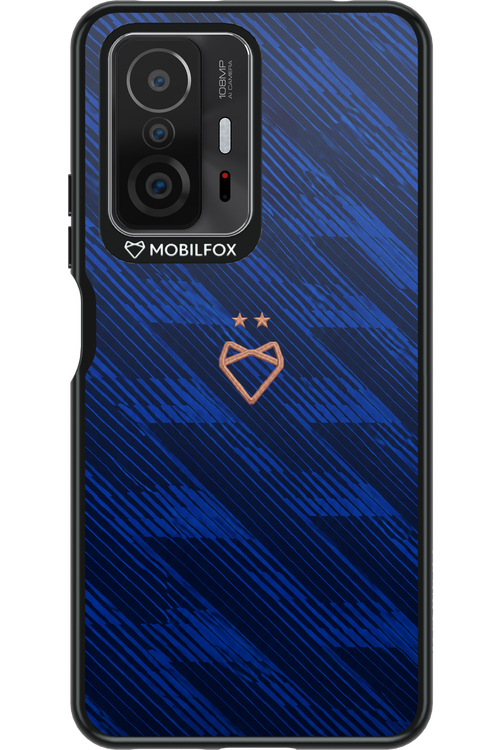 Franta 2.0 x Mobilfox 2.0 - Xiaomi Mi 11T Pro