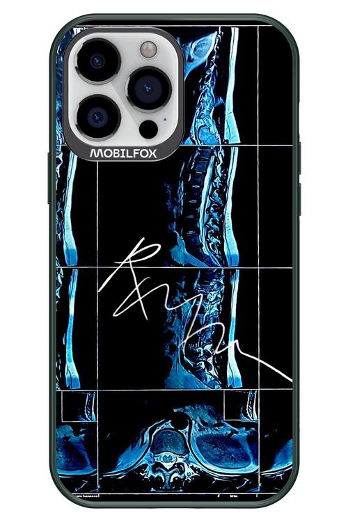 RMN Scolioza 2.0 - Apple iPhone 13 Pro Max