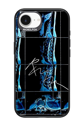 RMN Scolioza 2.0 - Apple iPhone 16e