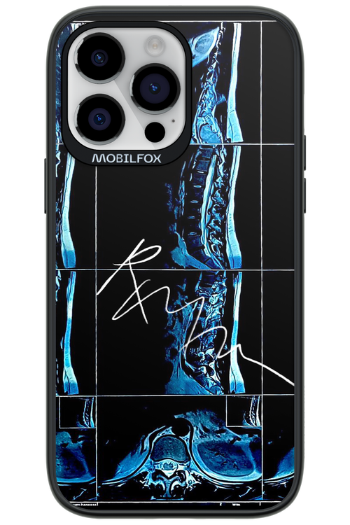 RMN Scolioza 2.0 - Apple iPhone 14 Pro Max