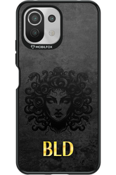 BLD MEDUSA 2.0 - Xiaomi Mi 11 Lite (2021)