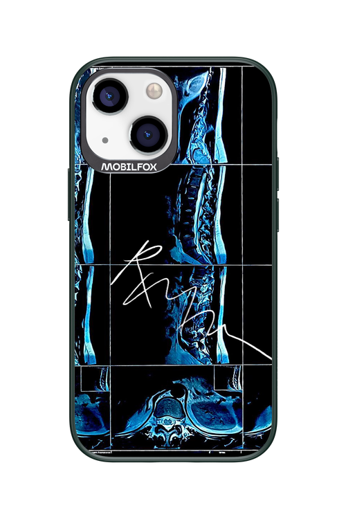 RMN Scolioza 2.0 - Apple iPhone 13 Mini