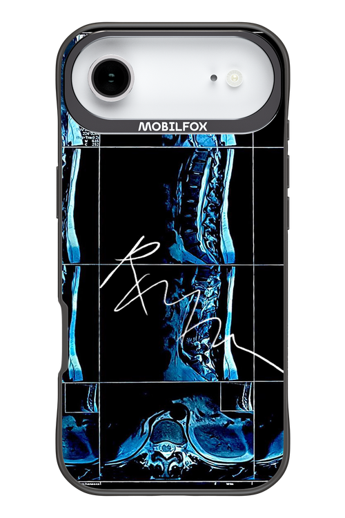 RMN Scolioza 2.0 - Apple iPhone 17 Air