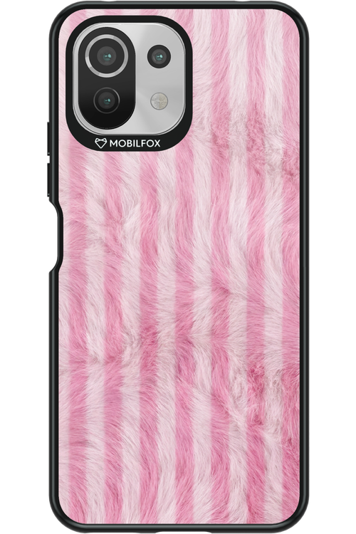 Furr Case 2.0 - Xiaomi Mi 11 Lite (2021)