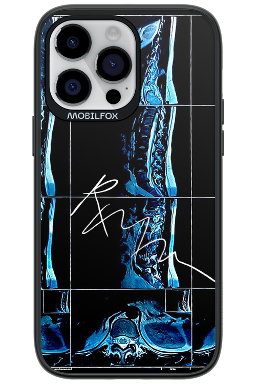 RMN Scolioza 2.0 - Apple iPhone 14 Pro Max