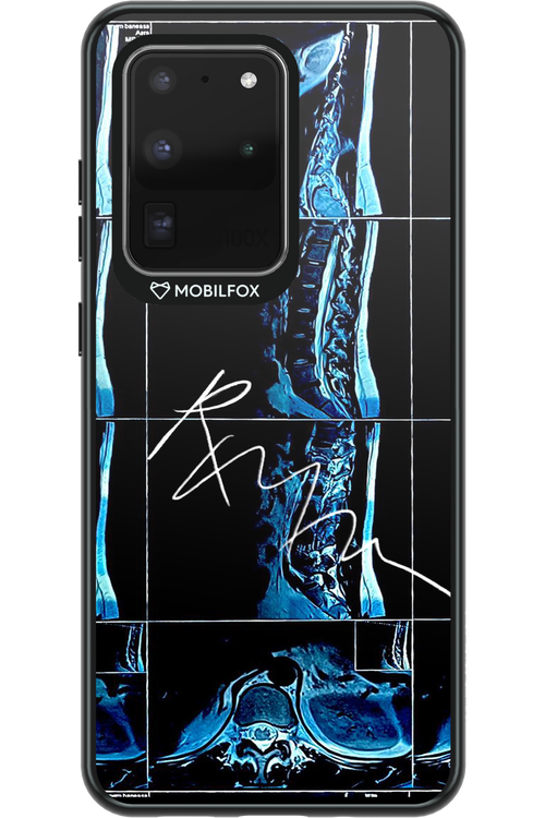 RMN Scolioza - Samsung Galaxy S20 Ultra 5G