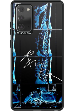 RMN Scolioza 2.0 - Samsung Galaxy Note 20