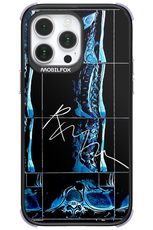RMN Scolioza 2.0 - Apple iPhone 14 Pro Max