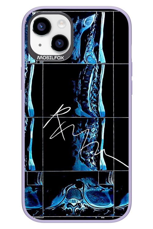 RMN Scolioza 2.0 - Apple iPhone 14 Plus