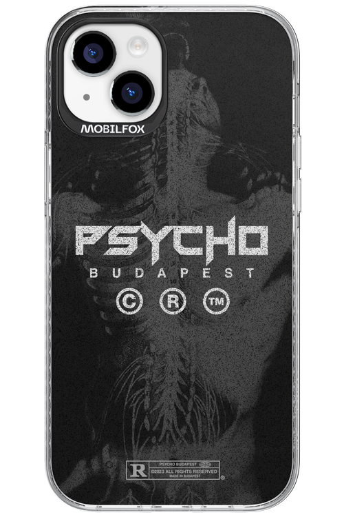 X-Ray - Apple iPhone 15 Plus