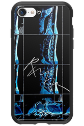 RMN Scolioza 2.0 - Apple iPhone SE 2022