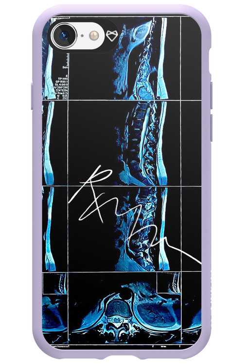 RMN Scolioza 2.0 - Apple iPhone SE 2022