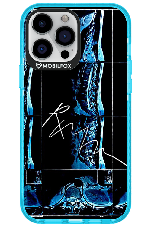 RMN Scolioza 2.0 - Apple iPhone 13 Pro Max