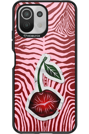 Kissy Cherry 2.0 - Xiaomi Mi 11 Lite (2021)