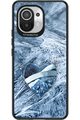 Ice 2.0 - Xiaomi Mi 11 5G