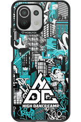HDC 3 2.0 - Xiaomi Mi 11 Lite (2021)
