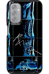 RMN Scolioza 2.0 - Samsung Galaxy A14
