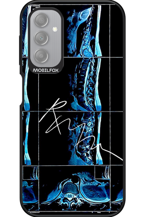 RMN Scolioza 2.0 - Samsung Galaxy A14