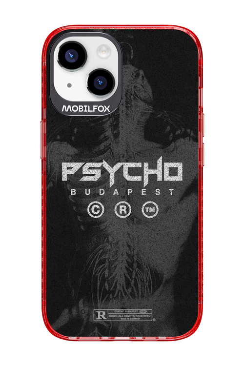 X-Ray - Apple iPhone 14