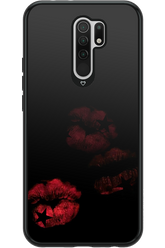 Kiss Star - Xiaomi Redmi 9