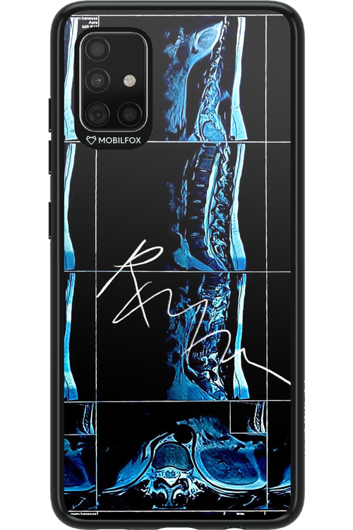 RMN Scolioza 2.0 - Samsung Galaxy A51