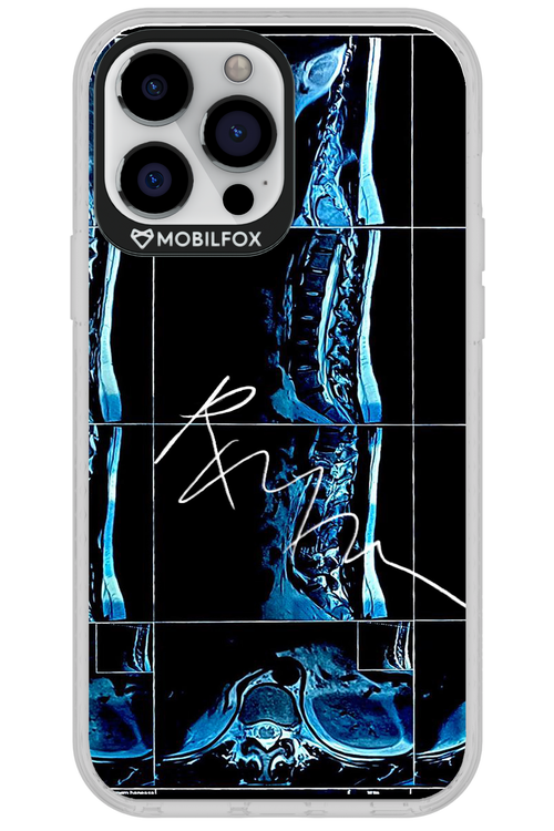 RMN Scolioza 2.0 - Apple iPhone 13 Pro Max