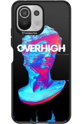 Overhigh - Xiaomi Mi 11 Lite (2021)