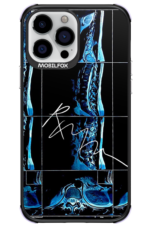 RMN Scolioza 2.0 - Apple iPhone 13 Pro Max