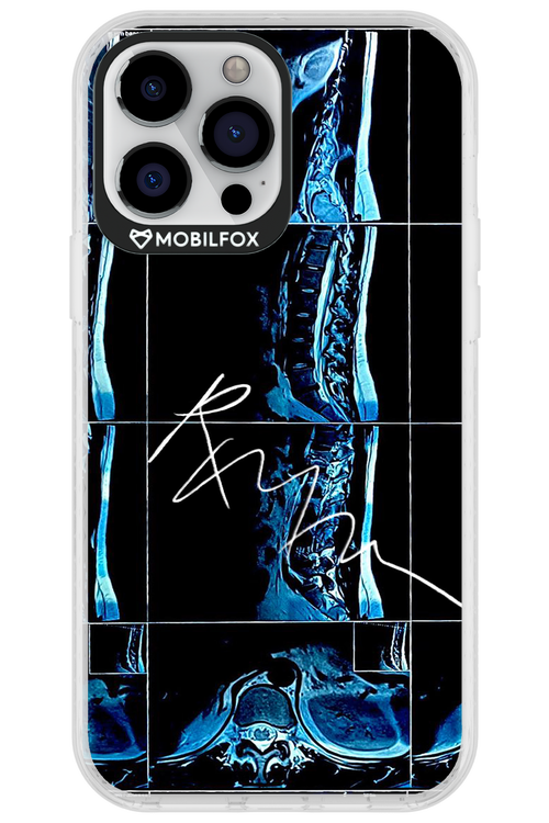 RMN Scolioza 2.0 - Apple iPhone 13 Pro Max