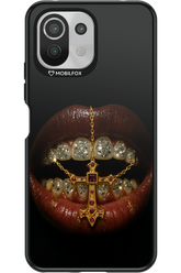 Greedy 2.0 - Xiaomi Mi 11 Lite (2021)