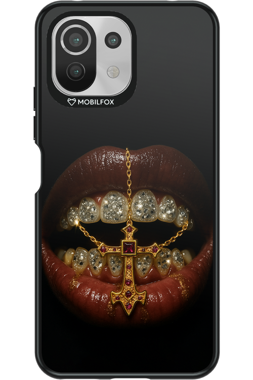 Greedy 2.0 - Xiaomi Mi 11 Lite (2021)