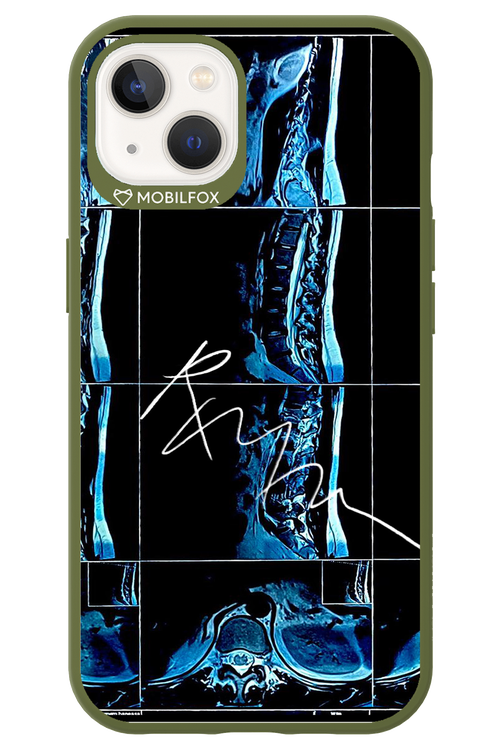RMN Scolioza 2.0 - Apple iPhone 13
