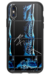 RMN Scolioza 2.0 - Apple iPhone X