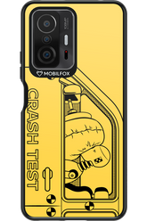 Crumple Zone 2.0 - Xiaomi Mi 11T