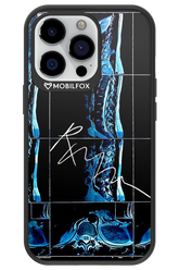 RMN Scolioza 2.0 - Apple iPhone 13 Pro