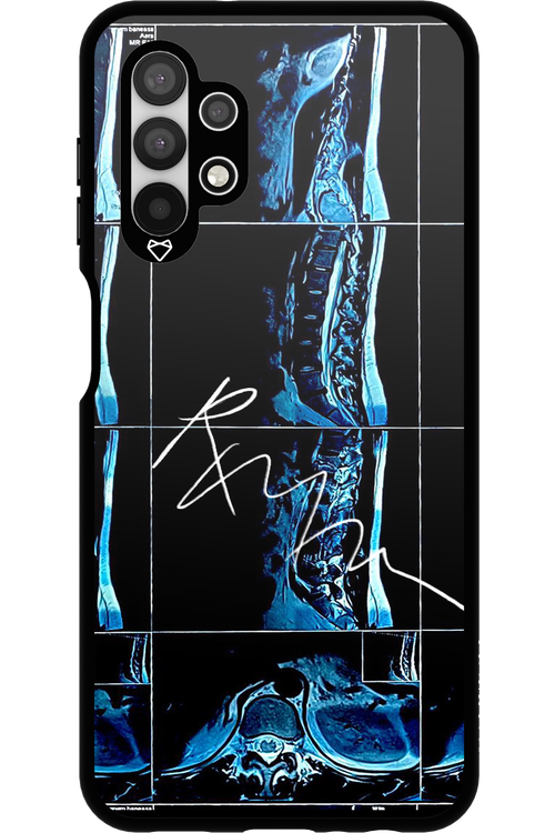 RMN Scolioza 2.0 - Samsung Galaxy A13 4G