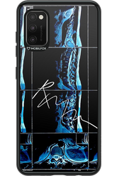 RMN Scolioza 2.0 - Samsung Galaxy A41