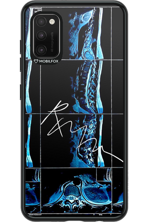 RMN Scolioza 2.0 - Samsung Galaxy A41