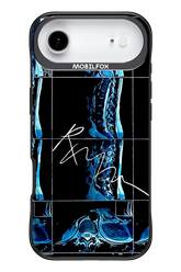 RMN Scolioza 2.0 - Apple iPhone 17 Air