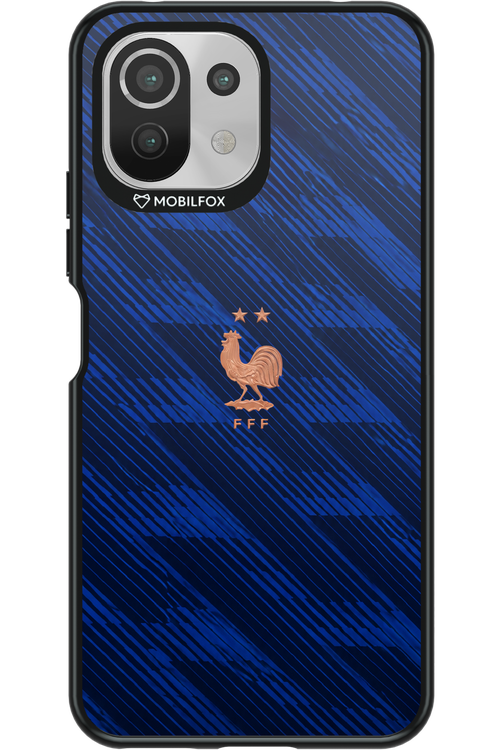 Franta 2.0 2.0 - Xiaomi Mi 11 Lite (2021)