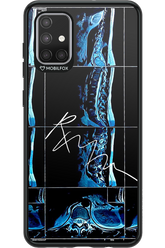 RMN Scolioza 2.0 - Samsung Galaxy A71