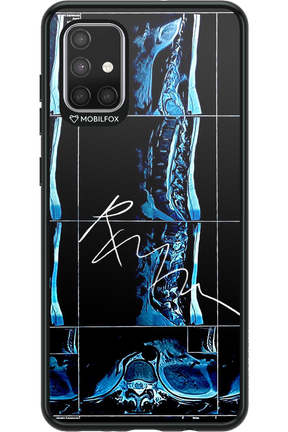 RMN Scolioza 2.0 - Samsung Galaxy A71