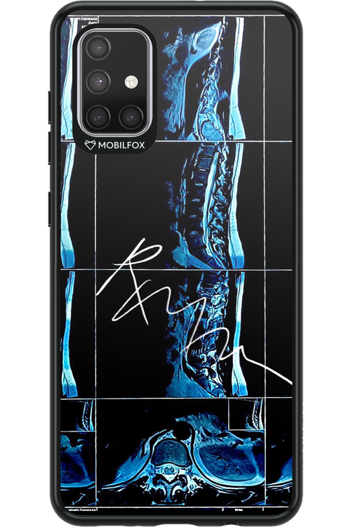 RMN Scolioza 2.0 - Samsung Galaxy A71