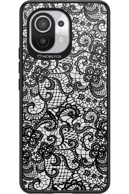 Spoiled 2.0 - Xiaomi Mi 11 5G