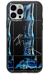 RMN Scolioza 2.0 - Apple iPhone 12 Pro