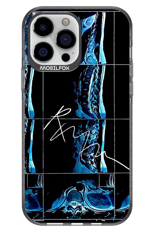 RMN Scolioza 2.0 - Apple iPhone 13 Pro Max