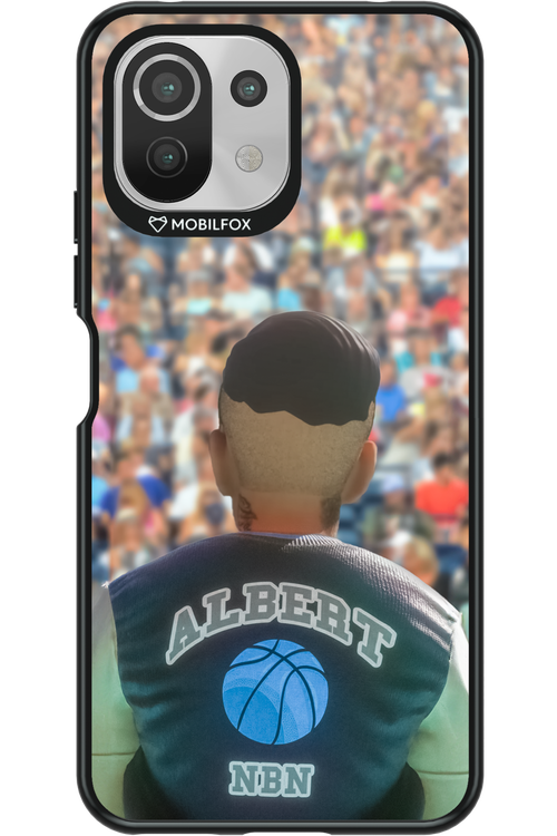 Albert 2.0 - Xiaomi Mi 11 Lite (2021)